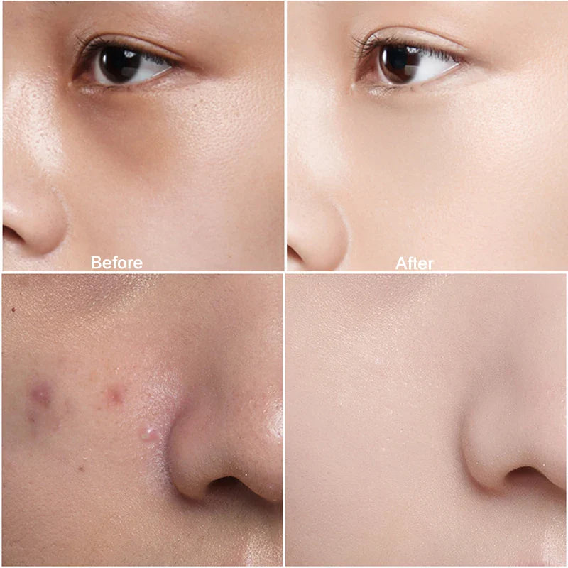 NOBB! Anticernes Bear Touch Up